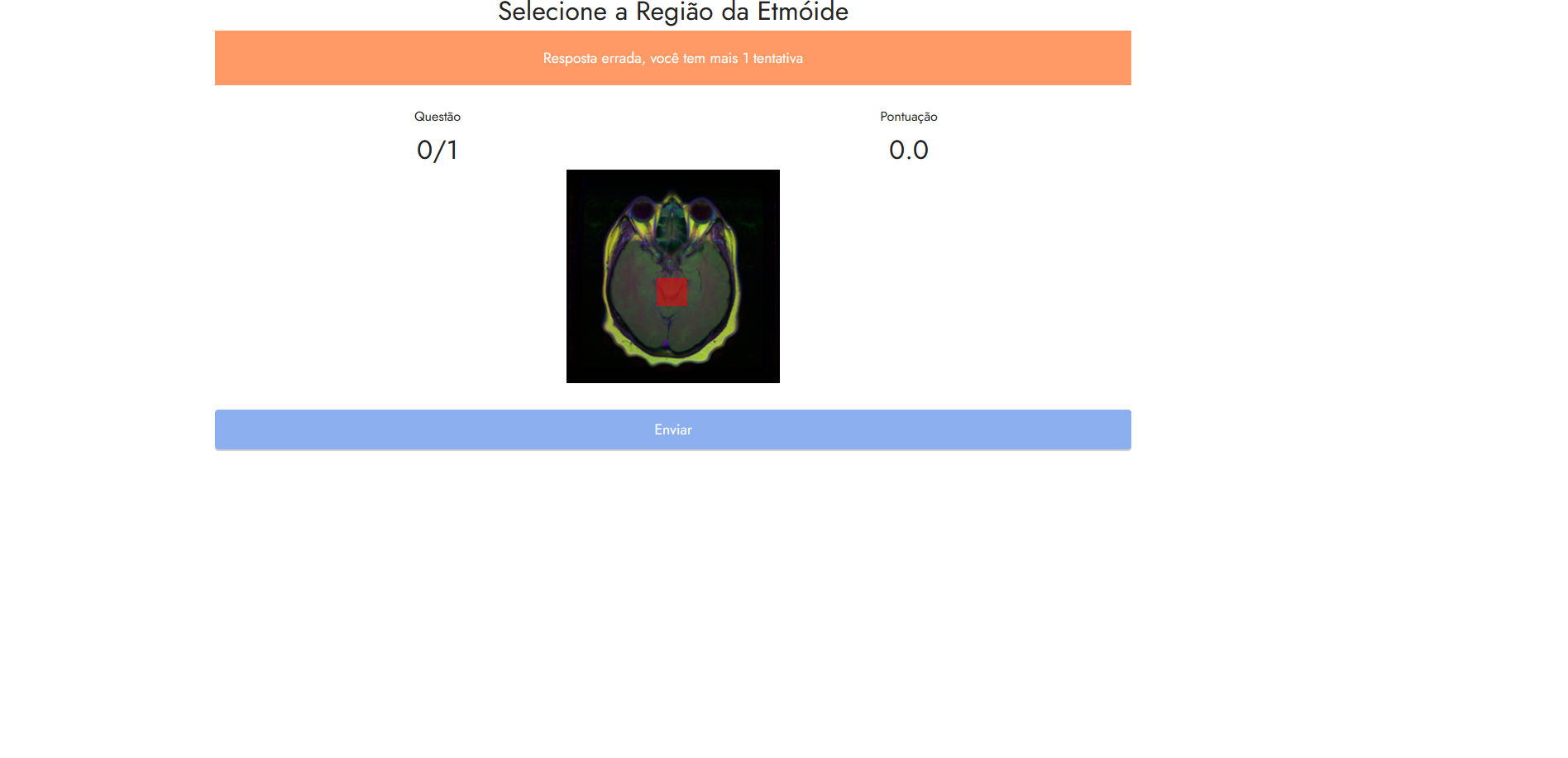 <p><strong>patologIA</strong> is a medical imaging training system that is comprised of four main modules.</p>

<ol>
	<li style="text-align:justify">Question Creation and Answer System This system has many sub-systems such as dynamic question creation for a single group or subject. Automatic result calculation system. Easy exam attempting system. and exam availability system.</li>
	<li style="text-align:justify">The second Module of patologIA is related to medical research studies. <strong>A teacher can upload a research paper or report in the system and a student can easily read it by searching the name of the study along with a unique ID that a teacher will give the student at the time of signup.</strong></li>
	<li style="text-align:justify">Prediction Module, In this module an <em>AI-trained Image processing model</em> will predict the diseases from the image of a <strong>CT Scan</strong> or <strong>X-ray</strong>, such as pneumonia or COVID-19.</li>
	<li style="text-align:justify">I have also developed a secure signup and login system for staff and students.</li>
</ol>